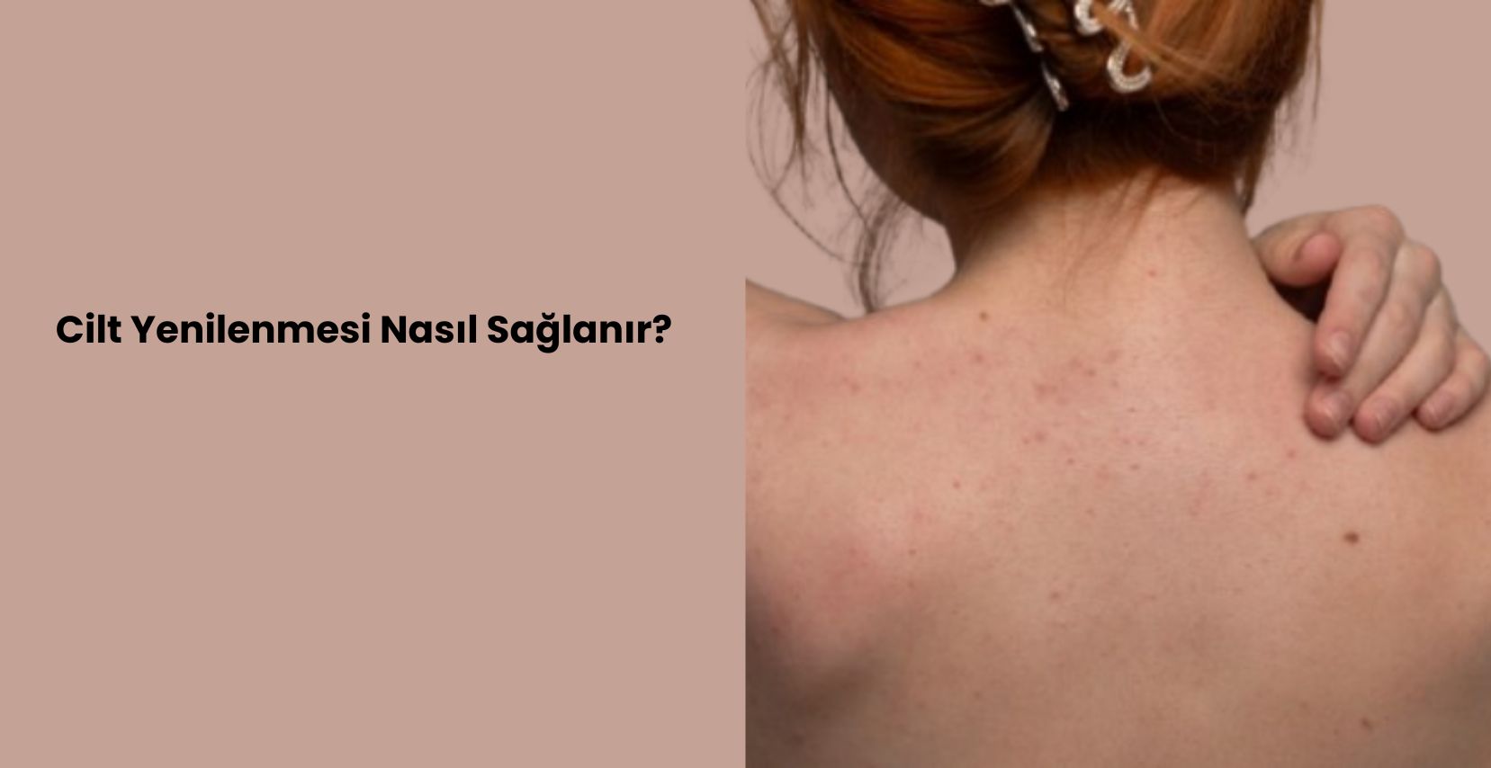 Cilt bariyerinizi neyin zayıflattığını keşfedin ve cerrahi olmayan uzman tedavilerle ışıltılı sağlığınıza kavuşun. Kişiselleştirilmiş danışmanlığınızı bugün ayırtın