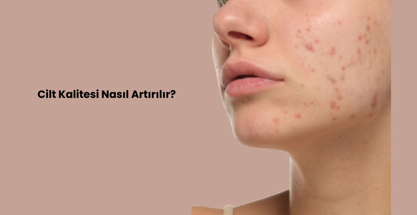 Hızlı, doğal sonuçlar için lazer, mezoterapi ve medikal cilt bakımı gibi uzman tedavilerle ameliyatsız cilt yenilemeyi keşfedin. Danışmanlığınızı bugün ayırtın