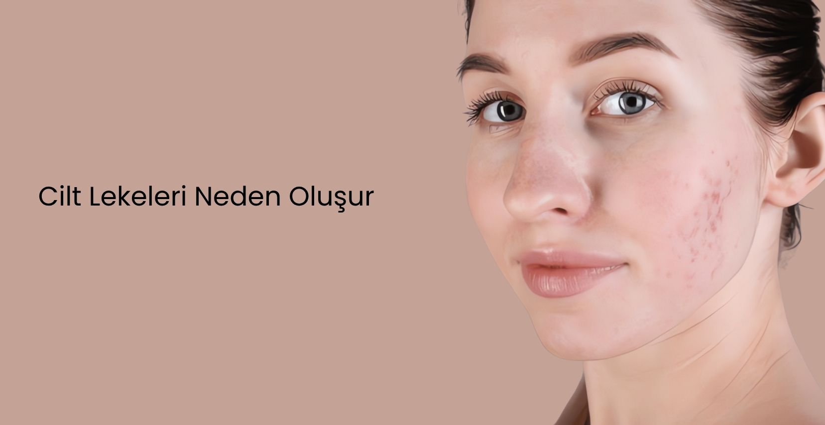 Cilt lekelerinin nedenlerini ve uzman tedavilerini öğrenin. Cerrahi olmayan çözümler ve hızlı iyileşme ile berrak, eşit bir cilde kavuşun. Danışmanlık hizmetinizi şimdi ayırtın