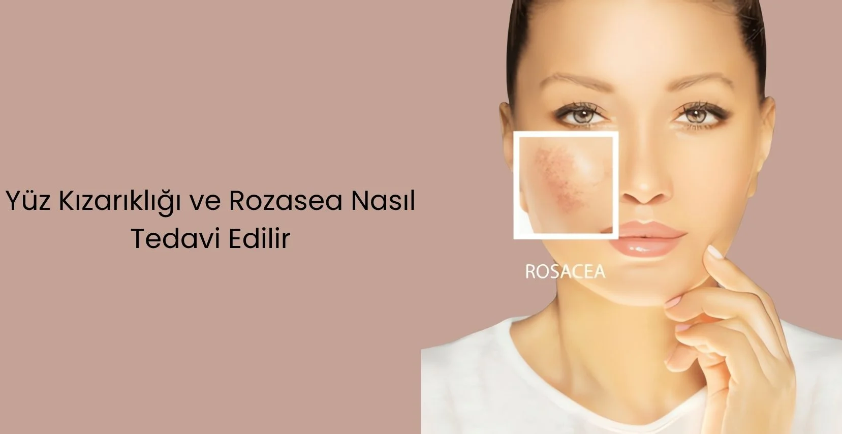 Uzman lazer terapisi, tıbbi cilt bakımı ve enjeksiyonlarla yüz kızarmasını ve rosacea'yı kontrol edin; konsültasyonunuzu bugün planlayın!